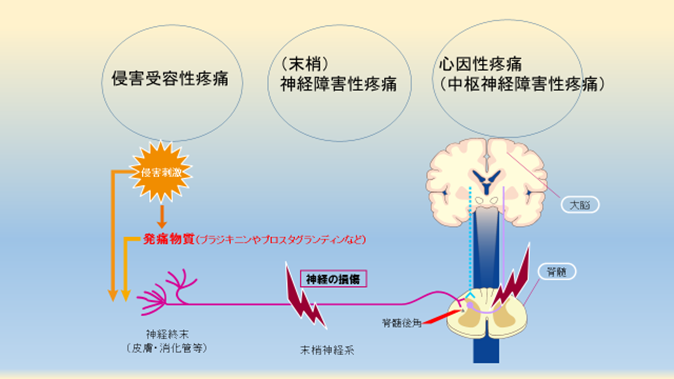 主な腰の痛みの種類と症状・原因まとめ | 辛 